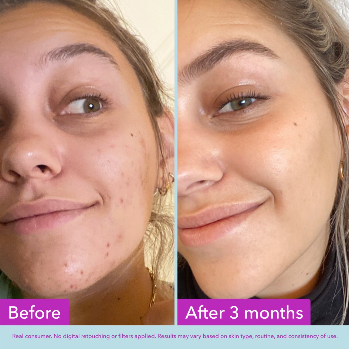 niacinamide-brightening-toner-o4 zb_p.jpg